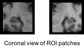 Coronal views of ROI inputs