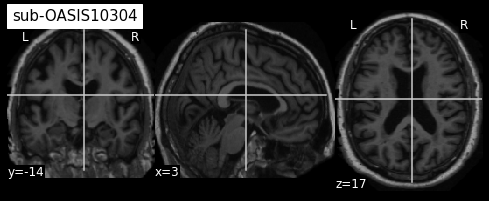 ../_images/preprocessing_11_3.png