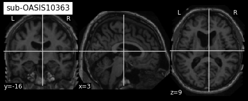 ../_images/preprocessing_11_4.png